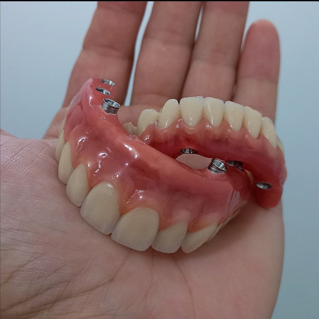 Full and Partial Dentures Melbourne — The Smile Designer